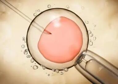 移植冷冻胚胎流程有哪些，部分患者可能会有不良反应